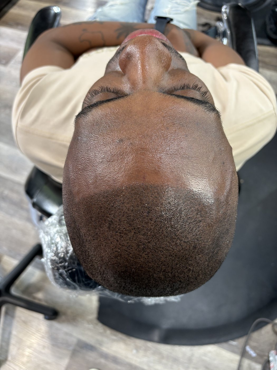 After scalp micropigmentation treatment